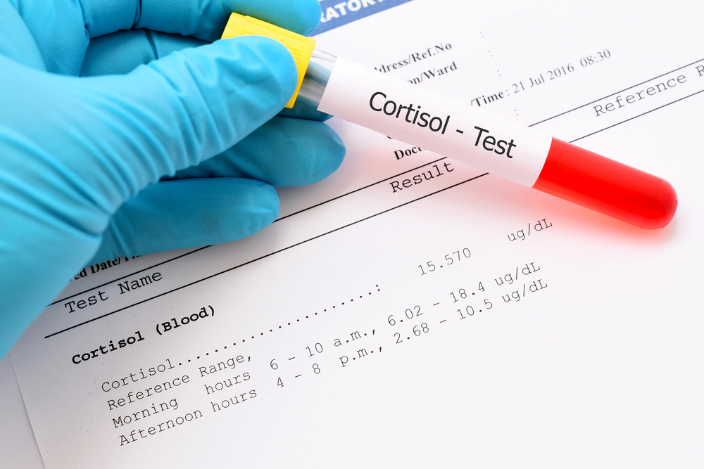 What does the Cortisol test mean?