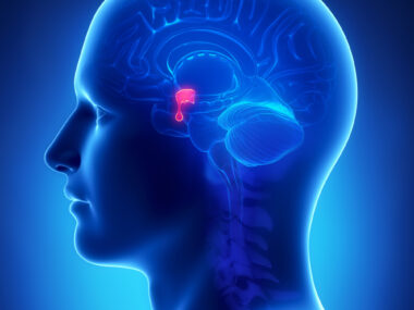 multiple tumors