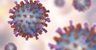hypercortisolism and COVID-19