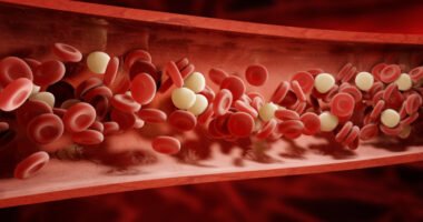 blood clotting risk