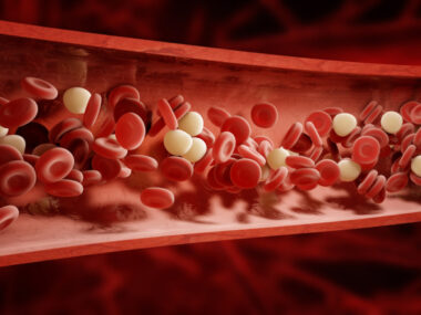 blood clotting risk