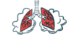 An illustration provides a close-up view of damaged human lungs.