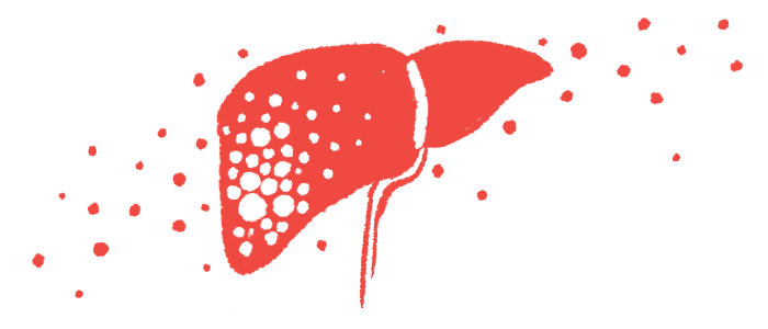 hepatitis C | Cushing's Disease News | illustration of the liver