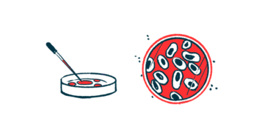 adult stem cells | Cushing's Disease News | illustration of a lab dish