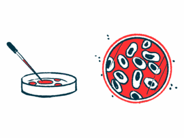 adult stem cells | Cushing's Disease News | illustration of a lab dish