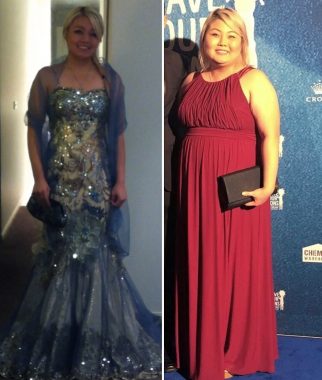 Cushing's disease diagnosis | Cushing's Disease News | Side-by-side photos show Ellijahna before and during Cushing's. In the left photo she is wearing a long, blue, sparkly dress, and in the right photo she is wearing a long red dress and has gained weight due to her disease.