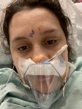 Noura takes a selfie in the hospital ahead of transsphenoidal surgery. They are wearing a hospital gown and have tubes inserted in their nose. A purple mark on their forehead indicates where the pituitary tumor is.