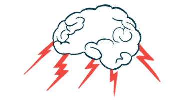 An illustration of a brain with lightning bolts.