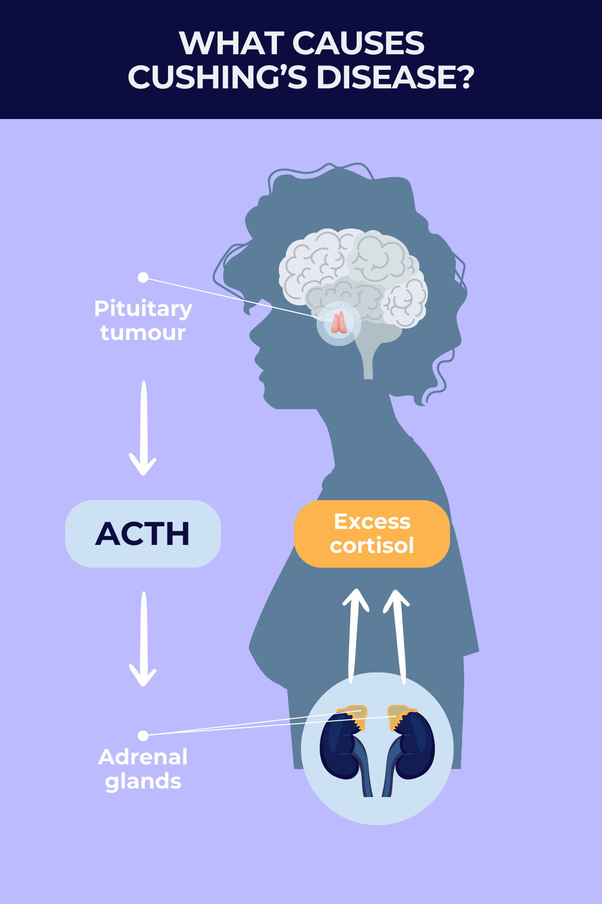 What causes Cushing’s disease? | Cushing's Disease News