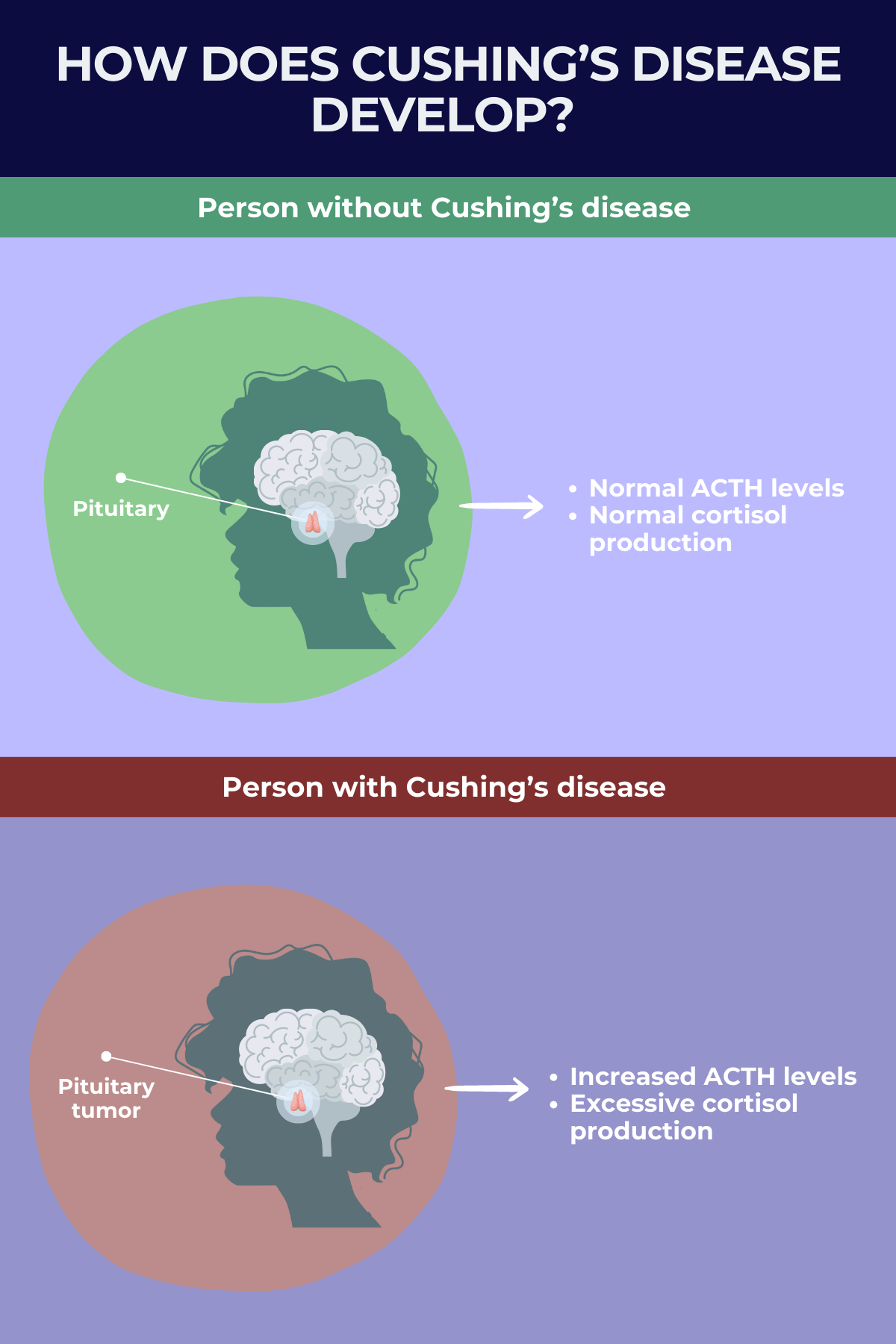 What is Cushing’s disease? Cushing’s Disease News