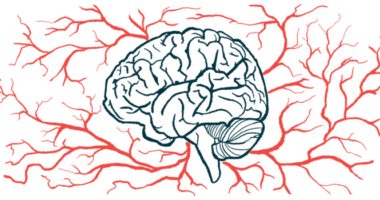 An illustration of the human brain, seen from the side with blood vessels surrounding it.