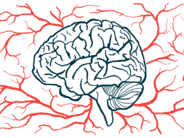 An illustration of the human brain, seen from the side with blood vessels surrounding it.