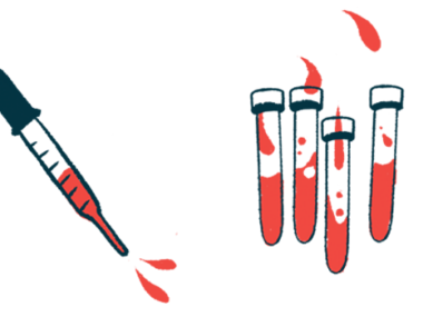 A dropper hovers next to four vials of blood.