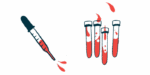 A squirting dropper is seen alongside four half-filled vials.