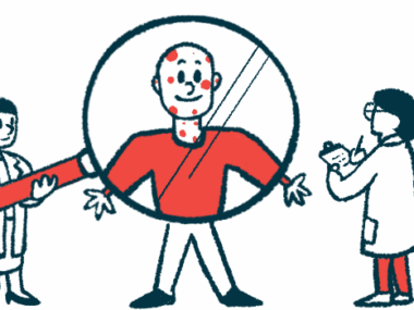 One medical professional holds a gigantic magnifying glass in front of a person whose face is covered with red spots while a second takes notes using a clipboard.