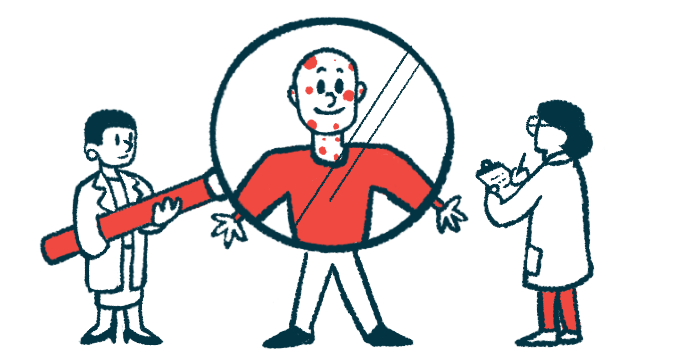 One clinician holds a giant magnifying glass in front of a patient whose face and neck are covered in red spots as another takes notes on a clipboard.
