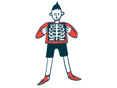 A person is shown holding an X-ray of their rib cage in front of their chest and stomach.