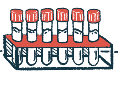 A rack holds six filled vials.