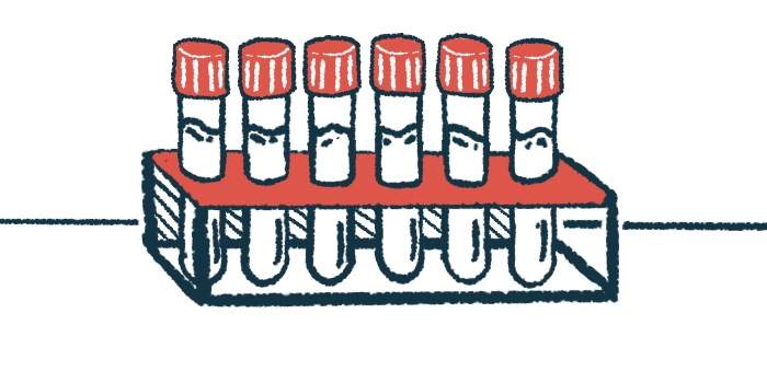 A rack holds six filled vials.