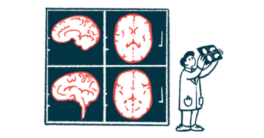 A doctor looks at an X-ray while four images of a brain are projected on a screen.