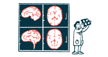 A doctor looks at an X-ray while four images of a brain are projected on a screen.