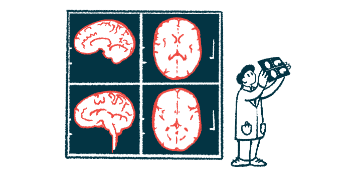 A doctor looks at an X-ray while four images of a brain are projected on a screen.