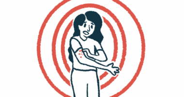 A woman scratches a rash on her arm.
