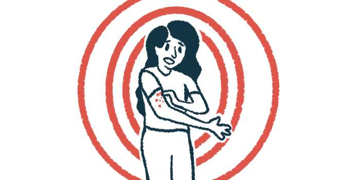 A woman scratches a rash on her arm.