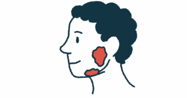 This illustration shows a person's head, with the location of the salivary glands highlighted in red.