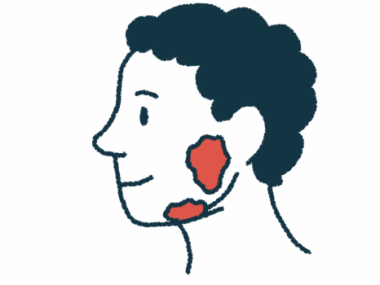 This illustration shows a person's head, with the location of the salivary glands highlighted in red.